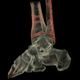 Image for article titled You Won't Believe How Accurate GE's New CT Scanner Is